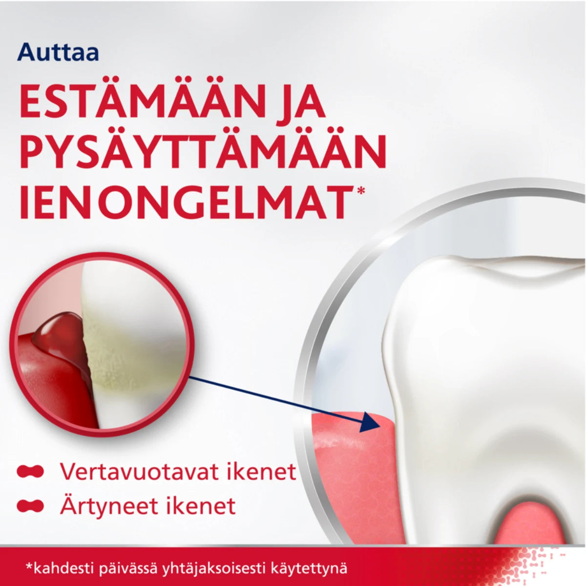 PARODONTAX Complete Protection auttaa pysäyttämään ienongelat