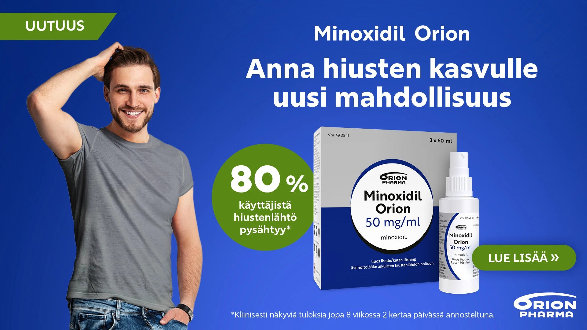 Uutta! Minoxidil Orion perinnöllisen hiustenlähdön hoitoon