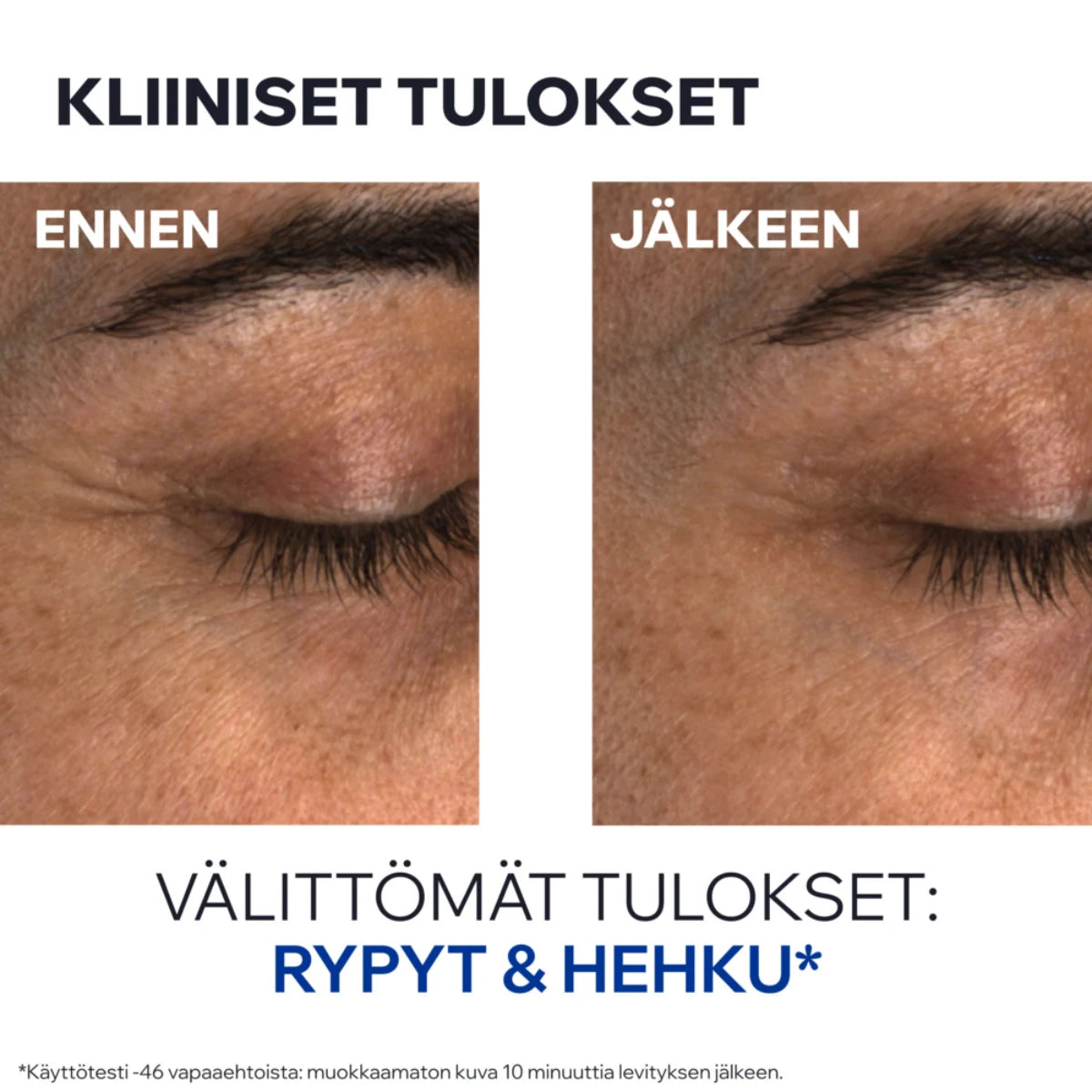 Uriage Age Absolu Blur-Redensifying Eye Balm tulokset ennen ja jälkeen