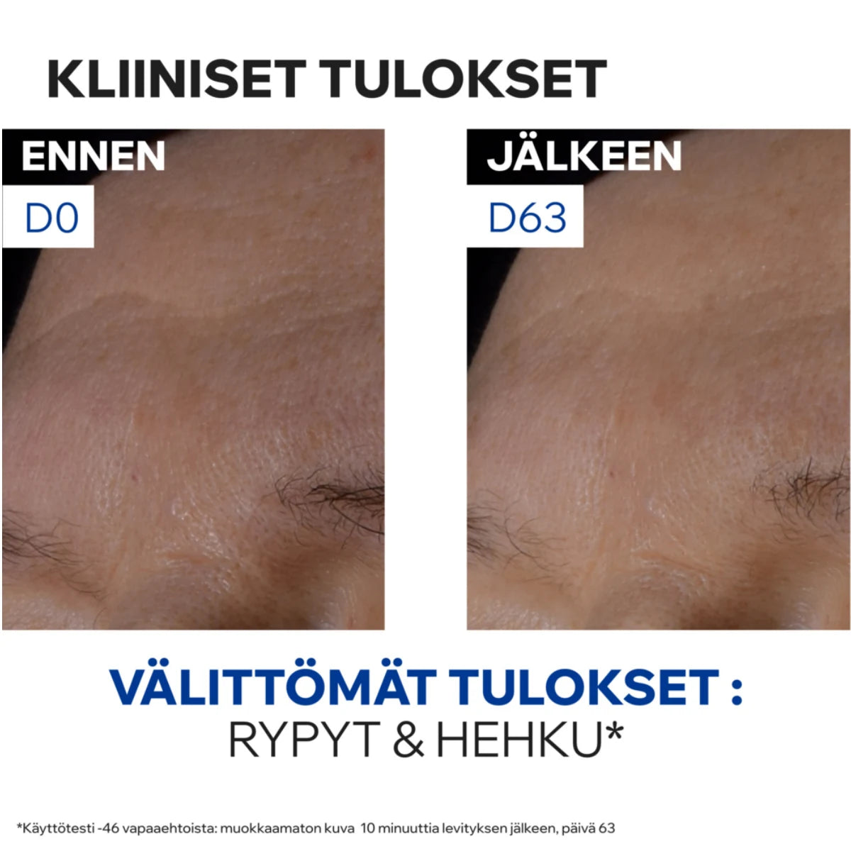 Uriage Age Absolu Redensifying Night Care tulokset 63 päivän jälkeen