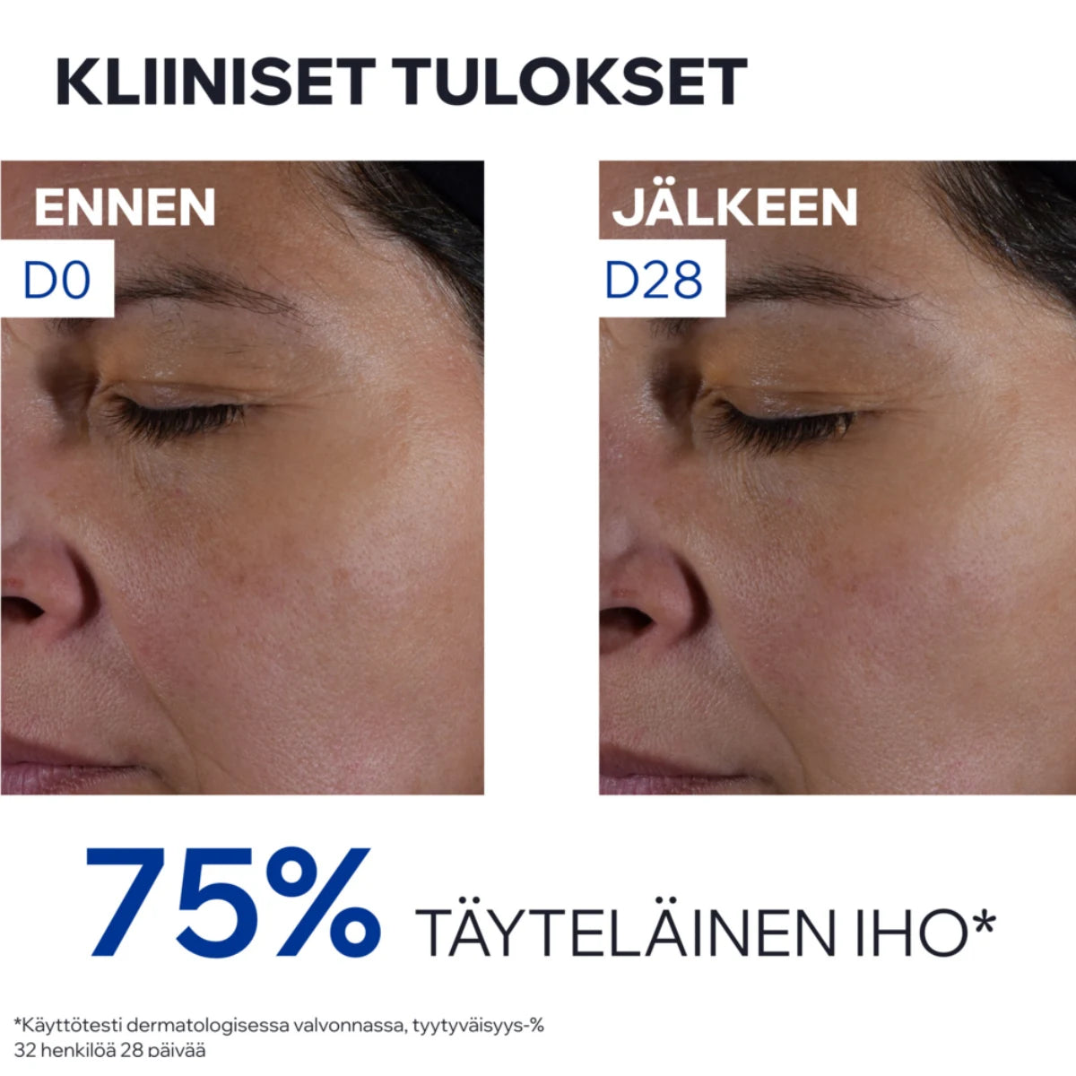 Uriage Age Absolu Redensifying tulokset 28 päivän jälkeen: 75% täyteläinen iho