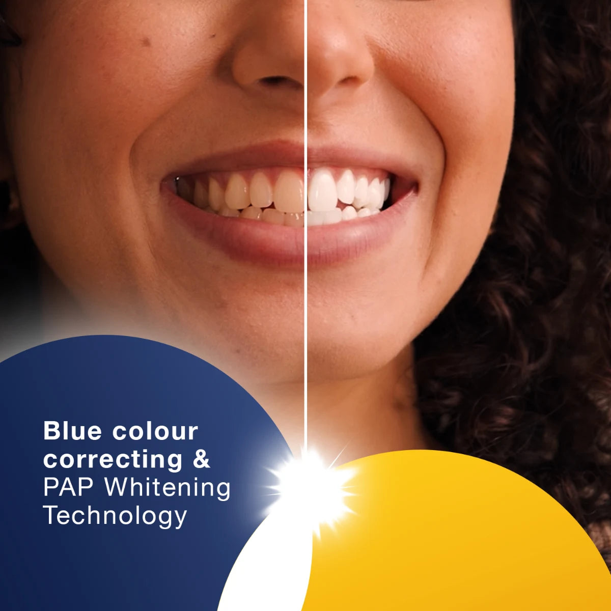 iWhite Colour Correcting Serum 30 ml – teknologia